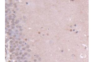Immunohistochemistry (IHC) image for anti-Ninein (GSK3B Interacting Protein) (NIN) (AA 1-153) antibody (ABIN7444640)