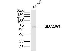 Mouse kidney lysates probed with SLC23A3 Polyclonal Antibody, Unconjugated  at 1:300 dilution and 4˚C overnight incubation. (SLC23A3 抗体  (AA 201-300))