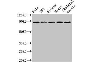 Western Blot Positive WB detected in: Hela whole cell lysate, 293 whole cell lysate, Rat kidney tissue, Mouse heart tissue, Mouse skeletal muscle tissue All lanes: SEMA3A antibody at 3. (SEMA3A 抗体  (AA 357-445))