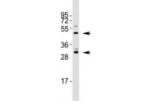 Western blot testing of Shh antibody at 1:1000 dilution + mouse stomach lysate; Predicted molecular weight: 45/27/19 kDa (1)