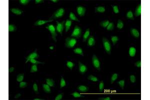 Immunofluorescence of monoclonal antibody to SH2D4A on HeLa cell. (SH2D4A 抗体  (AA 239-338))