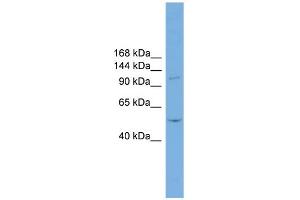 WB Suggested Anti-TNNI3K Antibody Titration:  0. (TNNI3K 抗体  (N-Term))