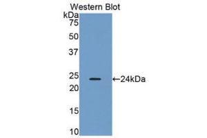 Western Blotting (WB) image for anti-Orosomucoid 2 (ORM2) (AA 19-201) antibody (ABIN1078413) (Orosomucoid 2 抗体  (AA 19-201))