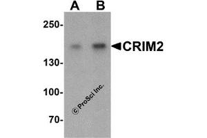 Western Blotting (WB) image for anti-Kielin/Chordin-Like Protein (KCP) (C-Term) antibody (ABIN1030344)