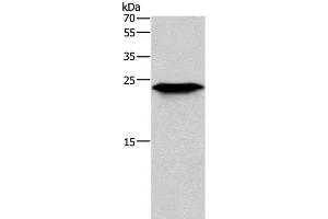 Western Blot analysis of Mouse skeletal muscle tissue using CD269 Polyclonal Antibody at dilution of 1:200 (BCMA 抗体)