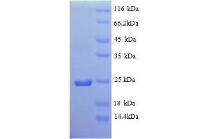 SDS-PAGE (SDS) image for Vesicle-Associated Membrane Protein 7 (VAMP7) (AA 2-188) protein (His tag) (ABIN1612678)