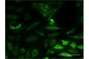 Immunofluorescence of monoclonal antibody to NT5M on HeLa cell. (NT5M 抗体  (AA 129-228))