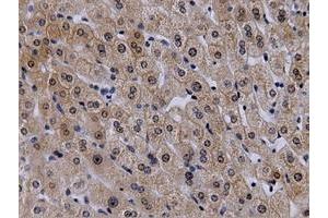 Immunohistochemical staining of paraffin-embedded Human liver tissue using anti-VWA5A mouse monoclonal antibody. (VWA5A 抗体)