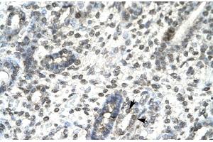 Immunohistochemistry (IHC) image for anti-T-Bet (Middle Region) antibody (ABIN2779750)
