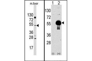 (LEFT)Western blot analysis of anti-AKT2 Antibody (N-term) Pab in mouse liver tissue lysates (35ug/lane). (AKT2 抗体  (N-Term))