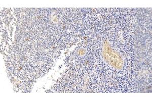 Detection of SDC1 in Human Tonsil Tissue using Monoclonal Antibody to Syndecan 1 (SDC1) (Syndecan 1 抗体  (AA 23-253))