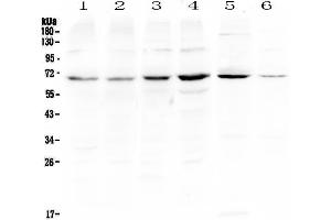 Western blot analysis of PIAS3 using anti-PIAS3 antibody . (PIAS3 抗体)