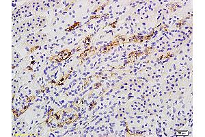 Formalin-fixed and paraffin embedded rat kidney labeled with Anti Catalase Polyclonal Antibody, Unconjugated (ABIN872991) followed by conjugation to the secondary antibody and DAB staining (Catalase 抗体  (AA 251-350))