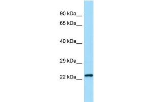 WB Suggested Anti-Chmp2b Antibody Titration: 1. (CHMP2B 抗体  (N-Term))