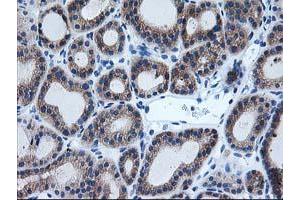 Image no. 3 for anti-Aryl Hydrocarbon Receptor Interacting Protein-Like 1 (AIPL1) antibody (ABIN1496508) (AIPL1 抗体)