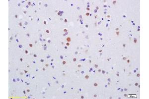Formalin-fixed and paraffin embedded rat brain labeled with Anti-Phospho-Histone H2A. (H2AFX 抗体  (pTyr143))