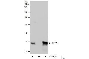 IP Image Immunoprecipitation of ETFA protein from HepG2 whole cell extracts using 5 μg of ETFA antibody, Western blot analysis was performed using ETFA antibody, EasyBlot anti-Rabbit IgG  was used as a secondary reagent. (ETFA 抗体  (Center))