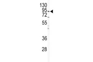 Western Blotting (WB) image for anti-Inhibitor of kappa Light Polypeptide Gene Enhancer in B-Cells, Kinase beta (IKBKB) antibody (ABIN3031320)