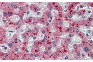 Immunohistochemistry (IHC) image for anti-ATP-Binding Cassette, Sub-Family B (MDR/TAP), Member 11 (ABCB11) (AA 421-663) antibody (ABIN7444397)