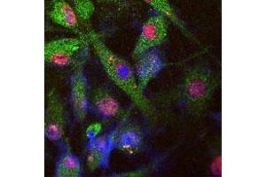 Tau-stable SY5Y cell image stained for endogenous LRRK (green) by Abgent L955a (affinity purified), phosphorylated tau (red, monoclonal AT8) and nuclear staining by DI. (LRRK2 抗体  (AA 930-961))