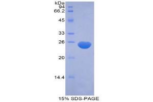 SDS-PAGE (SDS) image for Myosin, Light Chain 12B, Regulatory (MYL12B) (AA 5-172) protein (His tag,GST tag) (ABIN1877994)