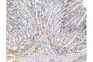 ABIN6265565 and ABIN6278949 at 1/100 staining mouse stomach tissue by IHC-P. (TIAF1 抗体)