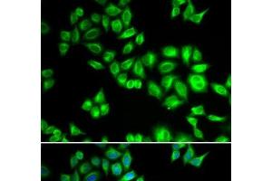 Immunofluorescence analysis of HeLa cells using CUL1 Polyclonal Antibody (Cullin 1 抗体)