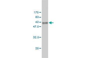 Western Blot detection against Immunogen (58. (RDH11 抗体  (AA 24-318))