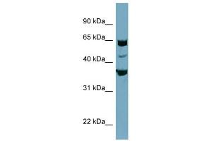 SEC22C antibody used at 1 ug/ml to detect target protein. (SEC22C 抗体)