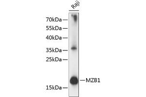 Western blot analysis of extracts of Raji cells, using MZB1 antibody (ABIN7268403) at 1:1000 dilution. (MZB1 抗体  (AA 1-189))