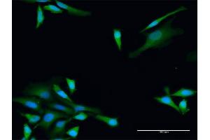 Immunofluorescence of purified MaxPab antibody to ADH5 on HeLa cell. (ADH5 抗体  (AA 1-374))