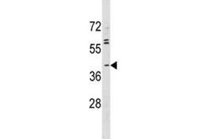 ABO antibody western blot analysis in MDA-MB231 lysate (ABO 抗体  (AA 41-68))