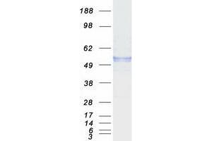 Validation with Western Blot