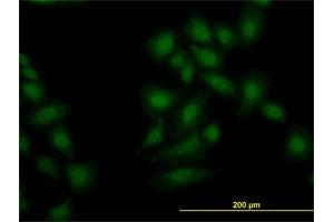 Immunofluorescence of monoclonal antibody to OXSR1 on HeLa cell. (OXSR1 抗体  (AA 1-527))