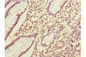 Immunohistochemistry of paraffin-embedded human small intestine tissue using ABIN7156265 at dilution of 1:100 (IKbIP 抗体  (AA 121-350))