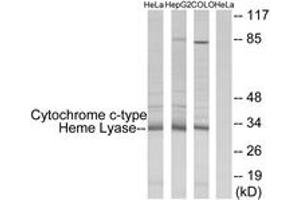 Western blot analysis of extracts from HeLa/HepG2/COLO cells, using Cytochrome c-type Heme Lyase Antibody. (HCCS 抗体  (AA 81-130))