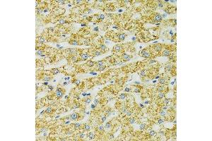 Immunohistochemistry of paraffin-embedded human liver using HSPA9 antibody. (HSPA9 抗体  (AA 380-679))