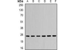 Western blot analysis of CDC34B expression in Jurkat (A), MCF7 (B), mouse liver (C), mouse kidney (D), rat brain (E), rat lung (F) whole cell lysates. (UBE2R2 抗体)