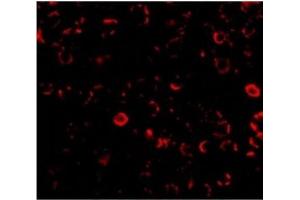 Immunofluorescence of TLR3 in El4 cells with CD283 / TLR3 antibody at 10 ug/ml. (TLR3 抗体  (C-Term))