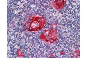 Immunohistochemistry (IHC) image for anti-Zinc Finger Protein 36, C3H Type, Homolog (Mouse) (ZFP36) (AA 41-90) antibody (ABIN768745)