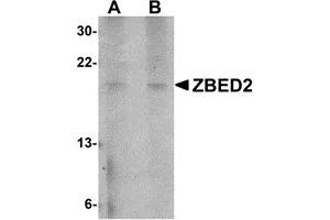 Western Blotting (WB) image for anti-Zinc Finger, BED-Type Containing 2 (ZBED2) (N-Term) antibody (ABIN1031669) (ZBED2 抗体  (N-Term))