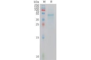 SDS-PAGE (SDS) image for Interleukin 23, alpha subunit p19 (IL23A) (AA 22-196) protein (Fc Tag) (ABIN7538341)
