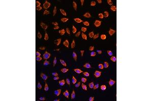 Immunofluorescence analysis of L929 cells using NOTCH3 Rabbit pAb (ABIN1681077, ABIN3015390, ABIN3015391 and ABIN6214032) at dilution of 1:100. (NOTCH3 抗体  (AA 751-850))