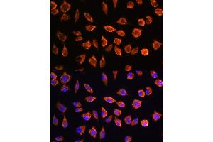 Immunofluorescence analysis of L929 cells using NOTCH3 Rabbit pAb (ABIN1681077, ABIN3015390, ABIN3015391 and ABIN6214032) at dilution of 1:100. (NOTCH3 抗体  (AA 751-850))