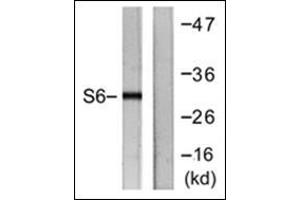 Western blot analysis of extracts from HeLa cells, treated with TNF-a 20ng/ml 2', using. (RPS6 抗体  (C-Term))