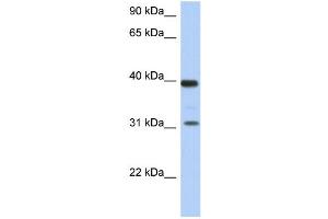 WB Suggested Anti-RPSA Antibody Titration: 0. (RPSA/Laminin Receptor 抗体  (Middle Region))