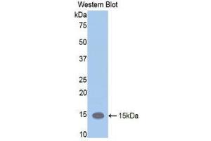 Western Blotting (WB) image for anti-Leukemia Inhibitory Factor Receptor alpha (LIFR) (AA 381-485) antibody (ABIN3208378) (LIFR 抗体  (AA 381-485))