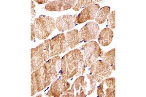 Immunohistochemical analysis of paraffin-embedded H. (COX6A2 抗体  (AA 37-66))