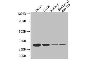 Western Blot Positive WB detected in: Mouse heart tissue, Mouse liver tissue, Mouse kidney tissue, Mouse skeletal muscle tissue All lanes: ADIPOQ antibody at 4 μg/mL Secondary Goat polyclonal to rabbit IgG at 1/50000 dilution Predicted band size: 27 kDa Observed band size: 27 kDa (ADIPOQ 抗体  (AA 19-244))