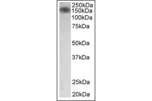 Staining of Human Colon lysate (35µg protein in RIPA buffer) using MYLK antibody at0. (MYLK 抗体  (Internal Region))